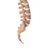 cousin-surgery-spine-intraspine-11